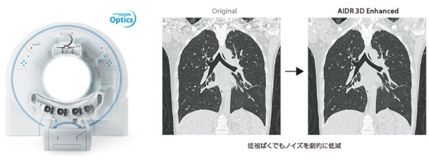 造影剤を使用するメリット